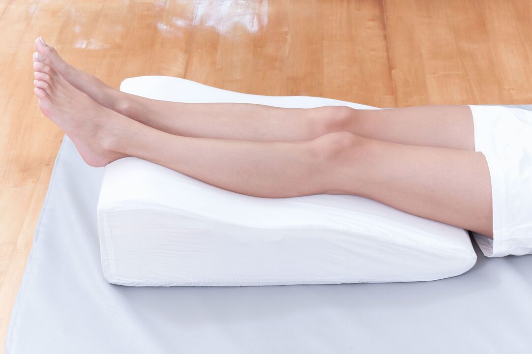 Prevención das varices
