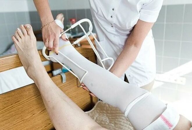 Período postoperatorio desde a cirurxía nas veas das pernas