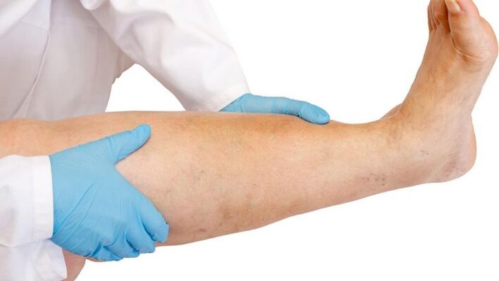 como identificar a enfermidade